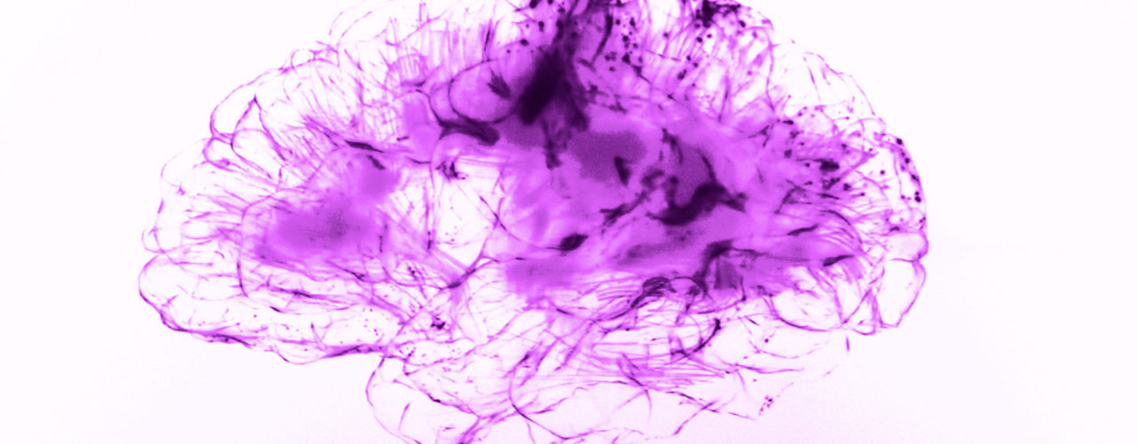 Neuronales Marketing Psychologie Neurowissenschaft Hirnforschung Online Marketing Verkaufen Sales Leads